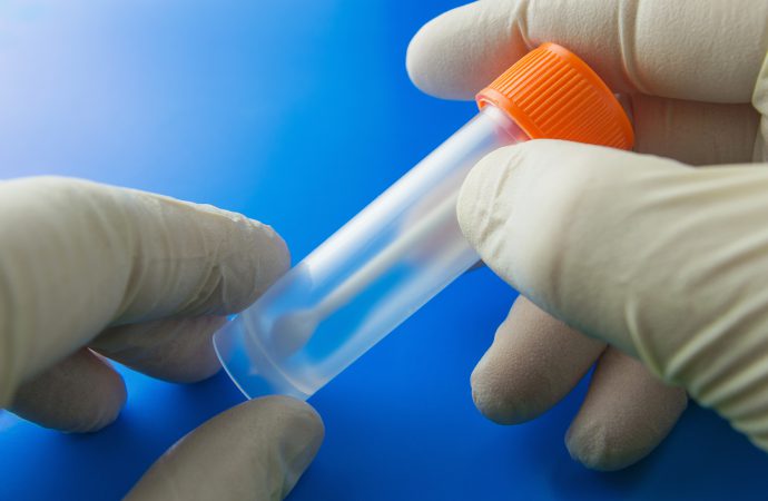Test na krew utajoną w kale – kiedy warto go wykonać?
